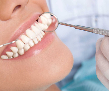 Лечение периодонтита