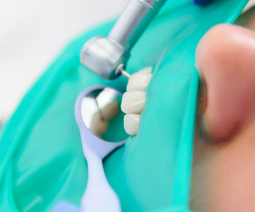 Лечение пульпита в зависимости от каналов