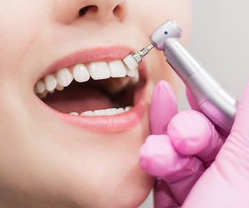 Профессиональная гигиена всей полости рта